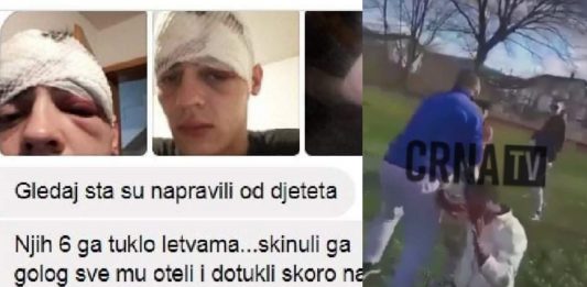 NOVI DETALJI IZ BIHAĆA: “I ALVIR JE MOLIO ZA POMOĆ PA SU GA TUKLI! PRETUKLI GA, UZELI MU PATIKE I JAKNU OD 400KM! NOVI DETALJI IZ BIHAĆA: “I ALVIR JE MOLIO ZA POMOĆ PA SU GA TUKLI! PRETUKLI GA, UZELI MU PATIKE I JAKNU OD 400KM!