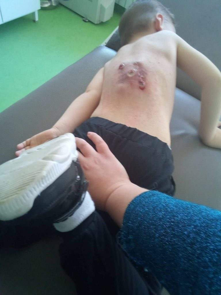Pomozimo petogodišnjem Bilalu Pomozimo petogodišnjem Bilalu