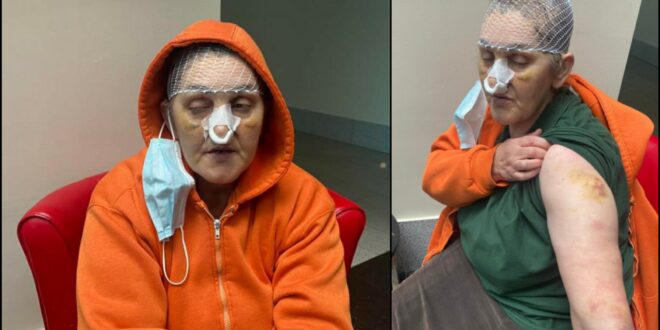Ispovijest Munevere koju je pretukla bivša snaha u Sarajevu: Žele nam oteti kuću! Ispovijest Munevere koju je pretukla bivša snaha u Sarajevu: Žele nam oteti kuću!
