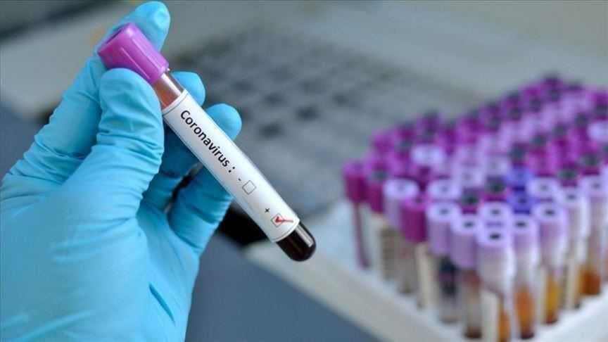 U BiH 380 novozaraženih koronavirusom, dvije osobe preminule U BiH 380 novozaraženih koronavirusom, dvije osobe preminule