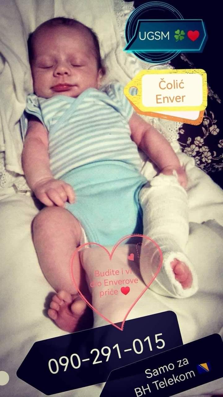 APEL ZA POMOĆ 20-mjesečnom Enveru Čoliću iz Kosove! (FOTO) APEL ZA POMOĆ 20-mjesečnom Enveru Čoliću iz Kosove! (FOTO)