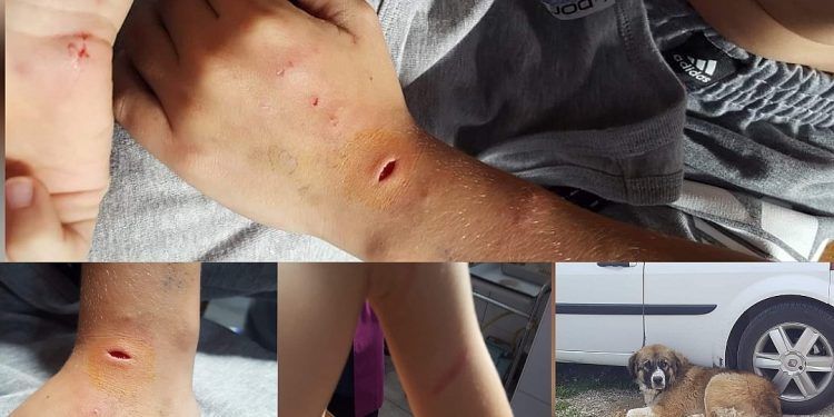 Drama u Velikoj Kladuši: U školskom dvorištu pas lutalica napao i izgrizao dječaka Drama u Velikoj Kladuši: U školskom dvorištu pas lutalica napao i izgrizao dječaka