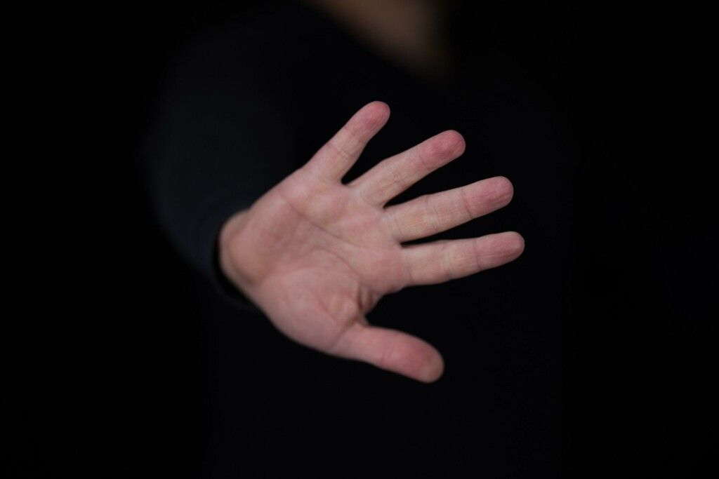 U Kosovi kod Maglaja brutalno pretučeno lice sa posebnim potrebama U Kosovi kod Maglaja brutalno pretučeno lice sa posebnim potrebama