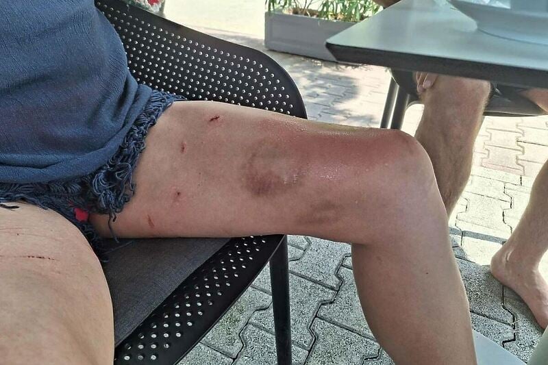 PRVO NOVAC PA SVE OSTALO:Neugodno iskustvo Bugojanke u Baškoj Vodi nakon što se srušilo stablo na plažu i povrijedilo je
