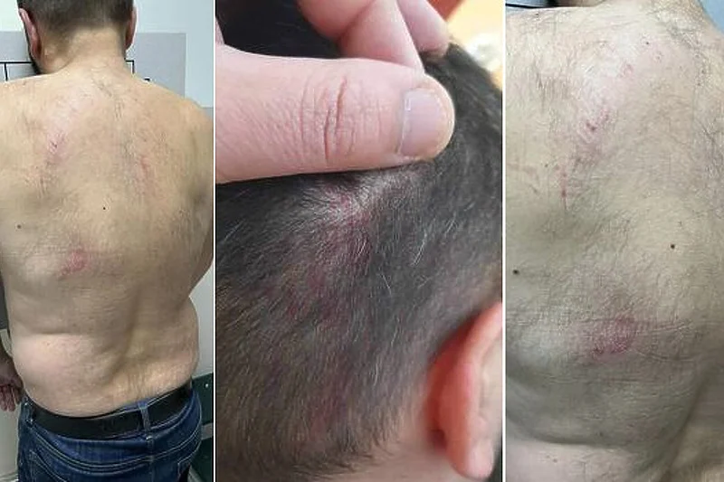Brutalno pretučen član glavnog odbora stranke Jelene Trivić, ona tvrdi: Tukli su ga SNSD-ovci